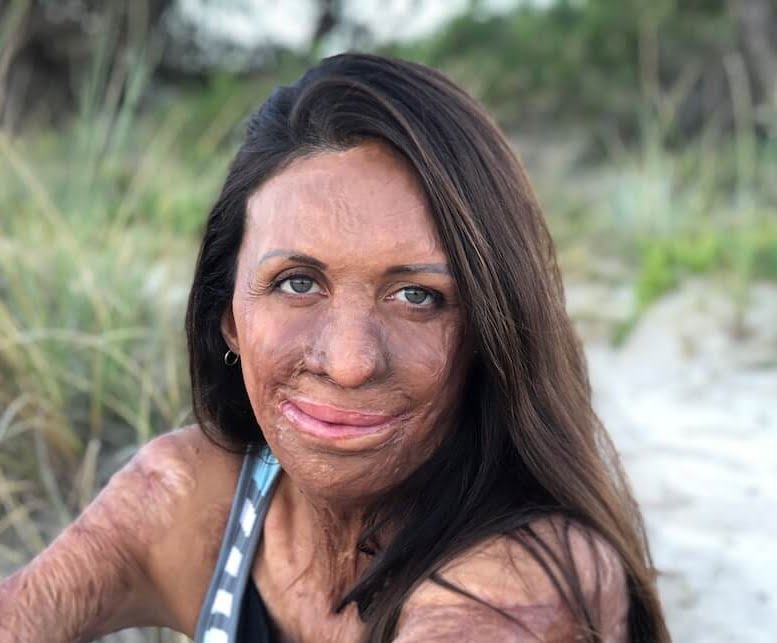 turia pitt
